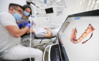 Diş hekimliğinde 3D tarayıcı ile ölçü alma derdi geride kaldı!