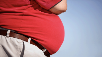 Dünya nüfusunun en az yarısı yakın gelecekte obez olacak